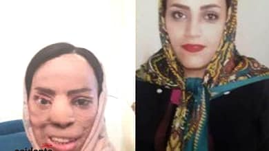 حادثه اسید پاشی زن برادر به خواهر شوهر - اخبار حوادث - سایت حوادث - اخبار - خبرگزاری
